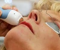 Warts  and birthmarks removal